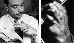 Playing Guitar With Arthritis - A picture of Django Reinhardt that shows his left-hand deformity.